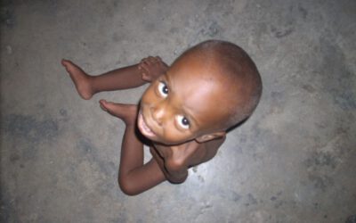 Hambruna en el cuerno de África