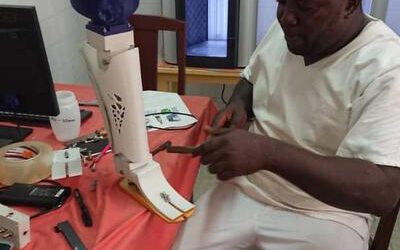 CAMERÚN – Douala – Prótesis que cambian vidas